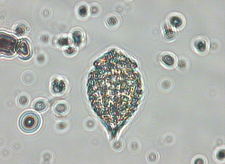 Dictyocha speculum